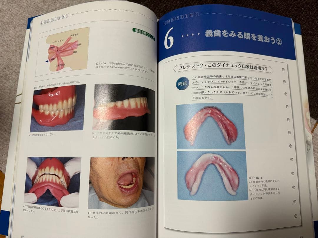 よい義歯だめな義歯 : 鈴木哲也のコンプリートデンチャー17のルール