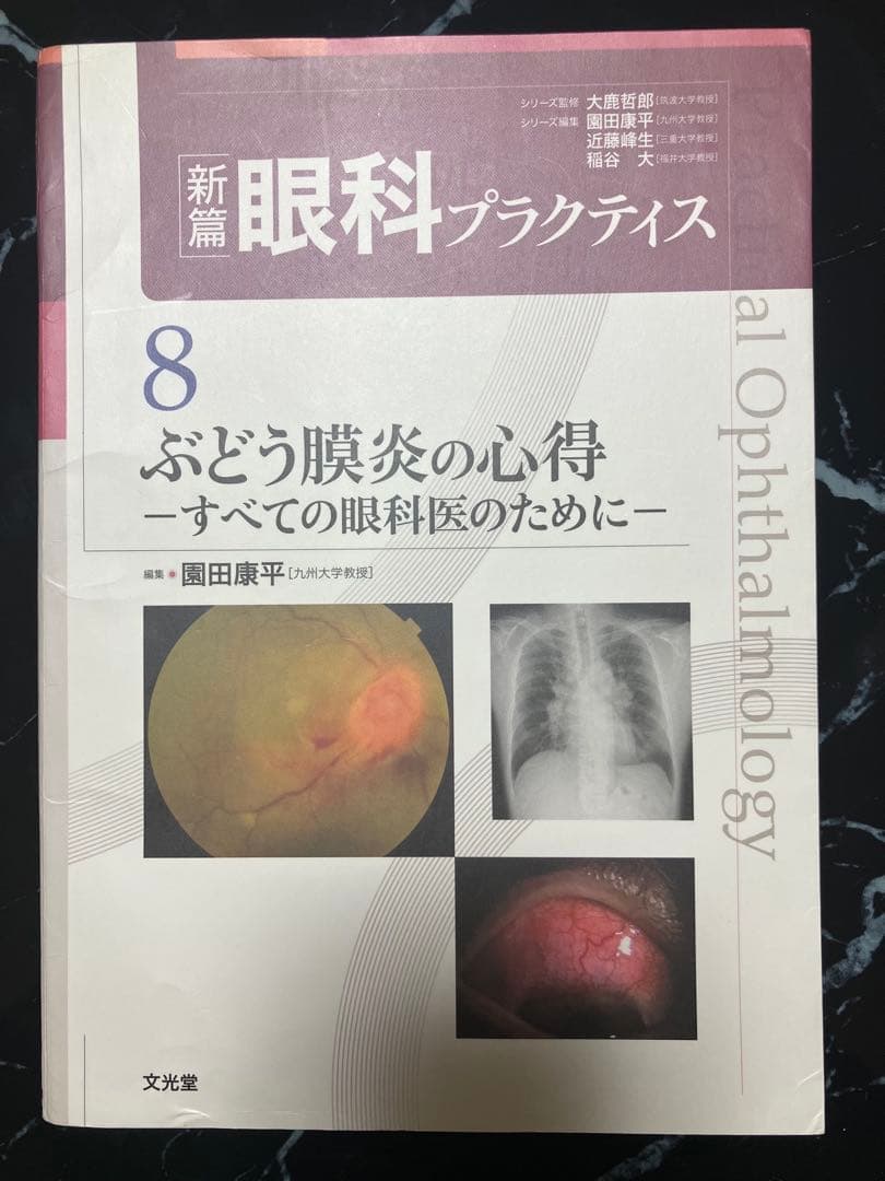 (裁断済み)眼科プラクティス8 ぶどう膜炎の心得