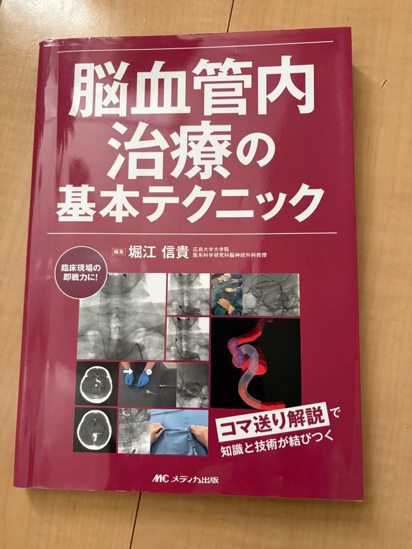脳血管内治療の基本テクニック