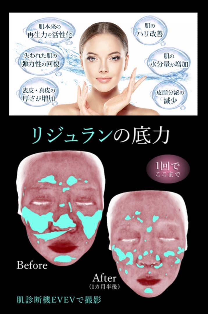 ミッヒィ　高純度リジュラン、グルタチオンStem Cell ブースター