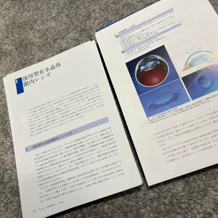 知っておきたい屈折矯正手術　裁断済