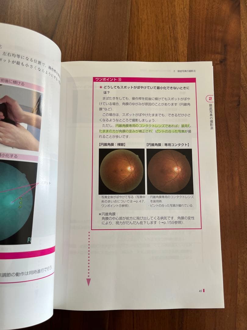 手にとるようにわかる健診のための眼底検査　改訂版　無散瞳カメラによる撮影と判定