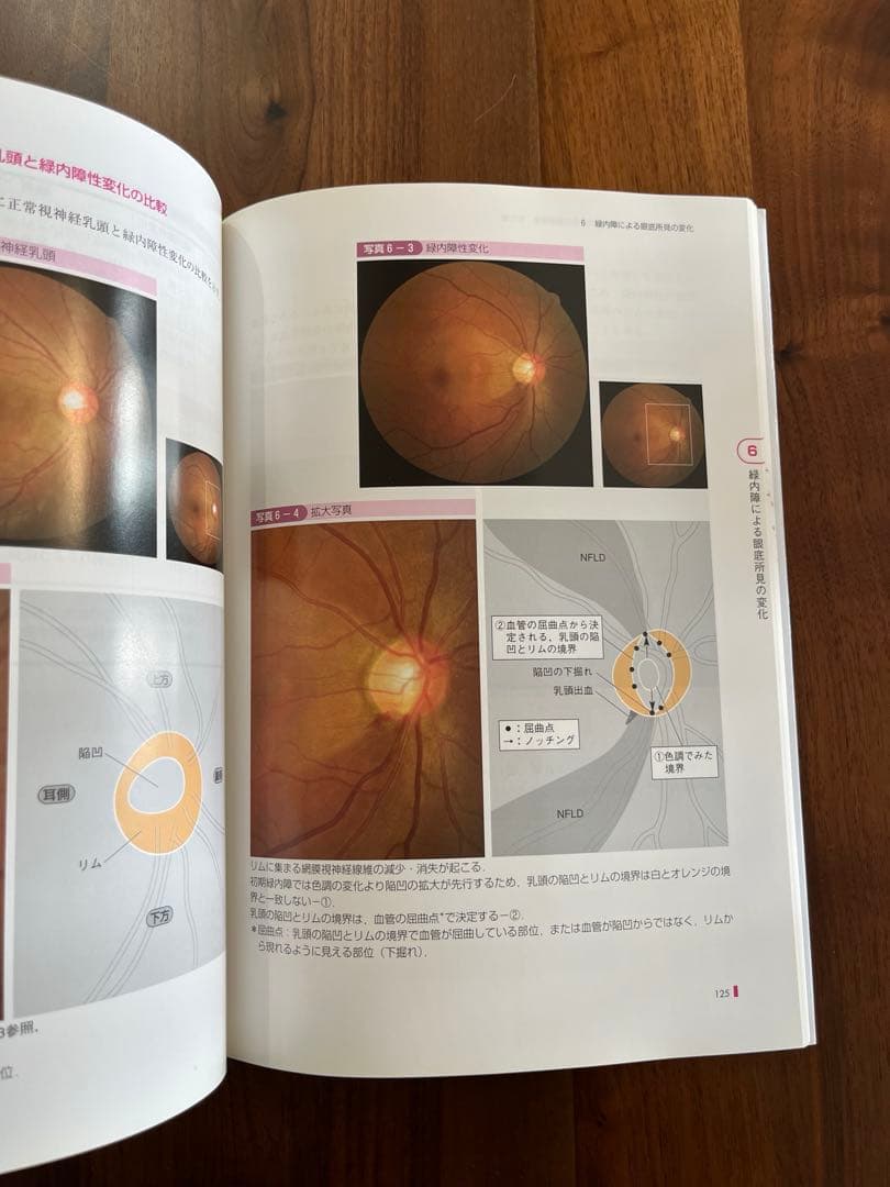 手にとるようにわかる健診のための眼底検査　改訂版　無散瞳カメラによる撮影と判定