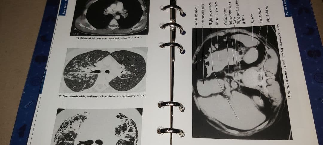 健康・医学 Pocket Medicine 7th Edition Ring Binder