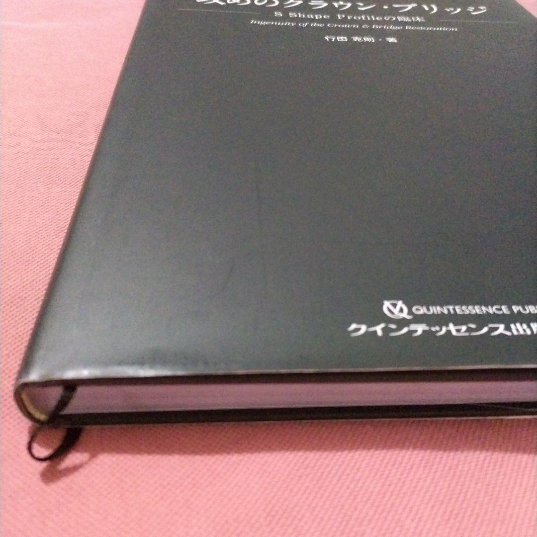 攻めのクラウン・ブリッジ = Ingenuity of the Crown &…